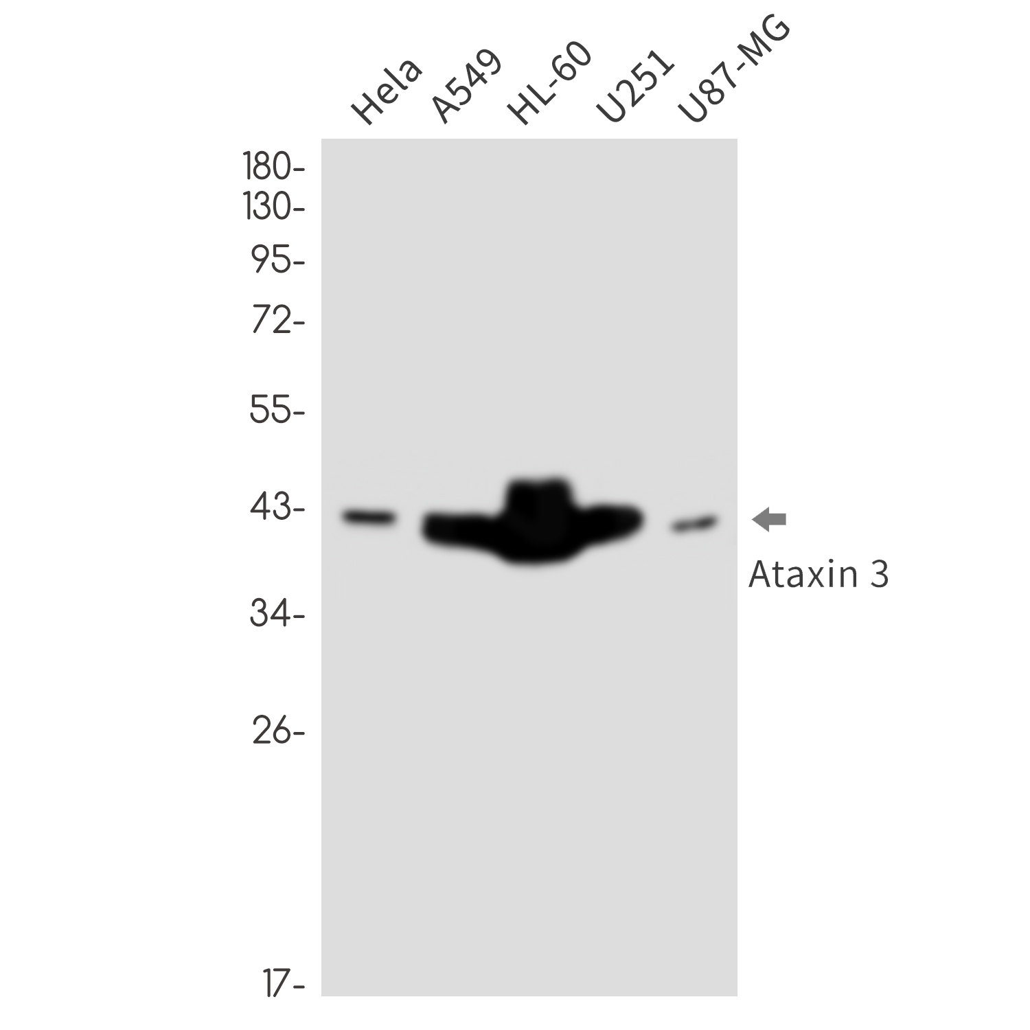 Ataxin 3 Rabbit mAb